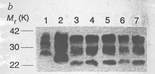 C S S S C Conversion S S S S S Aggregation HamsterScrapieBH Existence of PK-sensitive PrP (Nature Medicine, Oct 1998) Possible to detect the accumulated PrPsc with PK (PrP res ) for the diagnosis