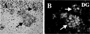 levels in all the congophilic plaques of human AD brain (Suh et al.