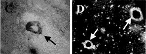 bulb, cerebral cortex and the limbic area, and its scarcity in