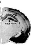 (Games et al., 1995; Zhan et al., 1995; Hsiao et al., 1996).