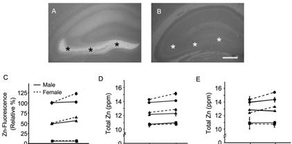 Brain Zinc: Its Possible Role in Alzheimer s Disease