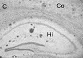 Znt3 dependence of amyloid plaque deposition happ +