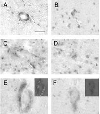 고재영 Reduced CAA in Tg2576/Znt3-null mice