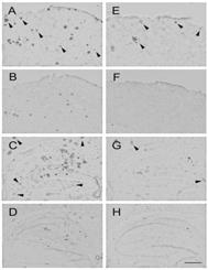 Pharm) Reduction of amyloid plaque