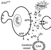 Amelioration of CAA by oral DP-109 or chelators Additional