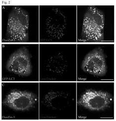 : activation of autophagy by clioquinol Zinc in autophagic