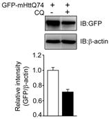 Synaptic zinc (ZnT3-dependent) plays a large role in the accumulation of amyloid plaques and CAA 2.