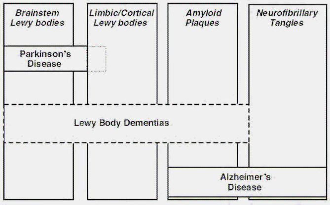 박경원 Brainstem Lewy bodies Limbic/Cortical Lewy bodies Amyloid Plaques Neurofibrillary Tangles Parkinson s Disease Lewy Body Dementias Alzheimer s Disease Figure 1.