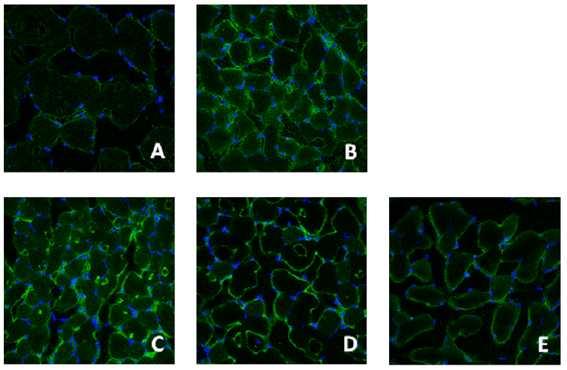 Fig. 4-9. Representative observations of skeletal muscles stained with Fluorescein sothiocyanate (FITC) for Akt in C57BLKS/J-db/db mice or C57BLKS/J-db/db mice.