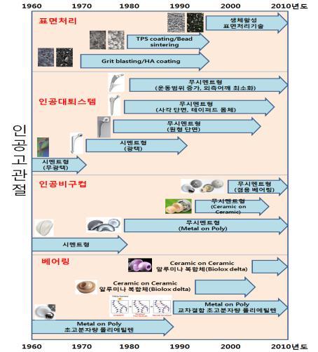 2) 산업의성장과정 1 인공고관절산업의성장과정 1961 년 John Charley 경이고안한저마찰 (Low Friction) 원리와골시멘트 (Bone Cement) 를도입하여최초의대퇴부용 Primary 인공관절이개발되었습니다.