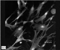 (d) The electrospun dcaffold with 15% elastin demonstrated a uniform elastin matrix throughout the vascular