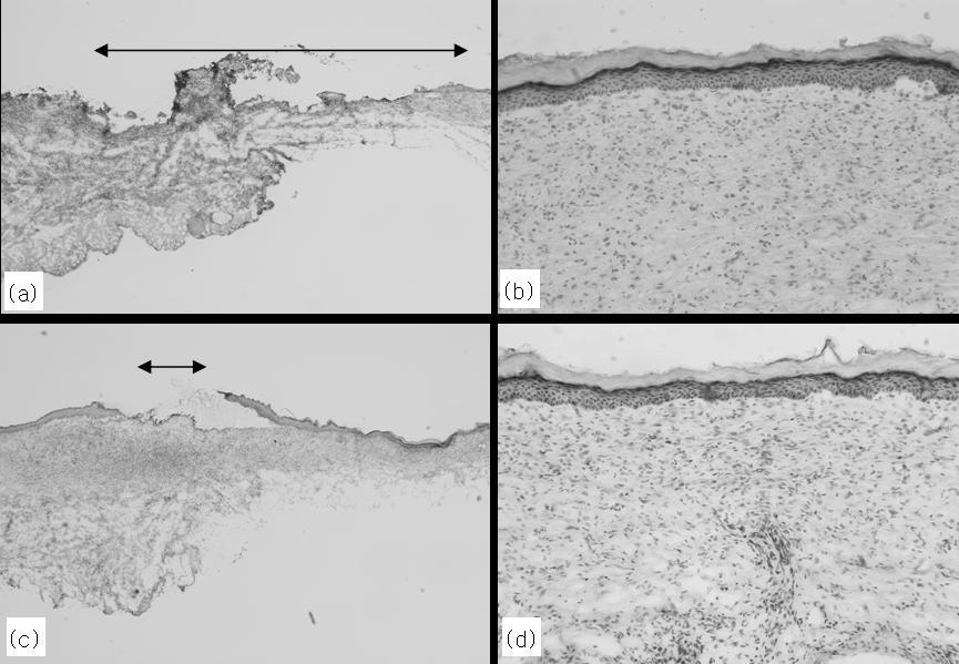 Representative photographs of wound healing of rat skin; Control group at 8 day and at 12 day, PHBV/collagen nanofiber group at 8 day, and at 12 day (d). 나노섬유쉬트를연구하였다.