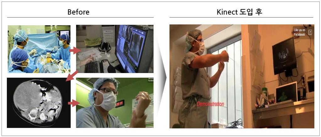 Leap Motion * 출처 : Leap Motion 홈페이지 의료사례 : Sunnybrook Hospital 이 MS Kinect 를도입하여수술실에서 MRI/CT Scan 확인시발생하는
