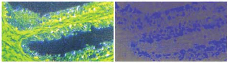 바이오이미징을위한업컨버전나노입자 (upconversion nanoparticles) 의합성및특성화 layer assembly) 은나노입자표면에교대로대전된폴리 이온 (polyions) 의정전기흡수를이용한다. 폴리이온의 층두께는정밀하게제어될수있다. 하지만이방법은친 수성나노입자에만적용할수있다는한계가있다.