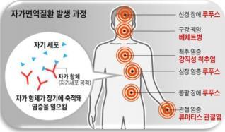 그림 2. 신체기관별자가면역질환 그림 3.