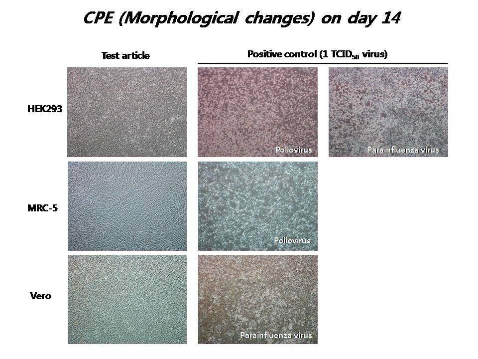 바이러스감염 14 일째 CPE 관찰 HEK293, M RC-5, Vero 세포가 seeding 된 plate 에 1TCID 50