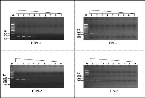 M: 100-bp ladder - Synthetic HTLV-1 과 2, 그리고 HIV-1 과 2 에대한유전자를각각이용하여정량화조건을확 립하였으며, 각 qrt-pcr 반응에는 10 6 ~ 10 분자수 copies 까지사용하였다 ( 그림