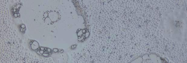 주간건강과질병 PUBLIC HEALTH WEEKLY REPORT, KCDC 473 병원체성장을억제시킨후세포에감염시켜세포병변효과를관찰한다. 감염된세포는보통 3-5 일배양후특징적인세포융합을형성하여다형거대세포를만들며세포중심에과립덩어리를둘러싸고있는고리를형성한다 (Figure 4).
