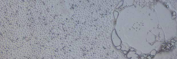 Measles virus cytopathic effect (CPE) in Vero/hSLAM cells 2013 년국내홍역발생현황 2013 년 4 월경상남도창원시에위치한 1 개고등학교에서 84 85 KC305687.1_MVs/CapeTown.ZAF/34.10 JX315599.1_MVs/Minnesota.USA/11.11 KC570915.1_MVi/Sur.