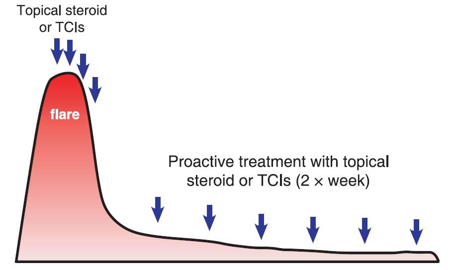 Future perspectives in the treatment of