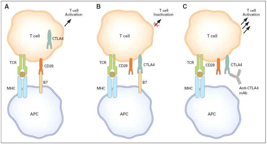 게된다는점임. 특히, 일부환자에서는 severe autoimmune colitis에의한장천공 (intestinal perforation) 이발생하여대장절제술 (colectomy) 을받아야했던경우도보고됨 (J Clin Oncol. 24:2283-2289).