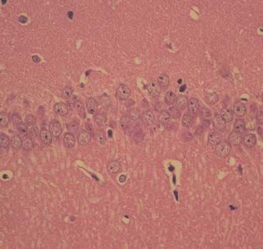 D3 injected experimental group (C, D). (A) Control group shows diffuse degeneration of neurons in CA1.