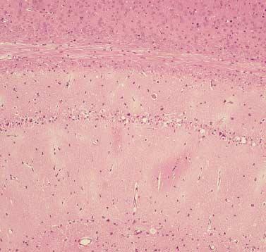 (C, D) D3 injected experimental group shows well preserved neurons in CA1 and CA2-3 area. 에서유의하게감소되었다.