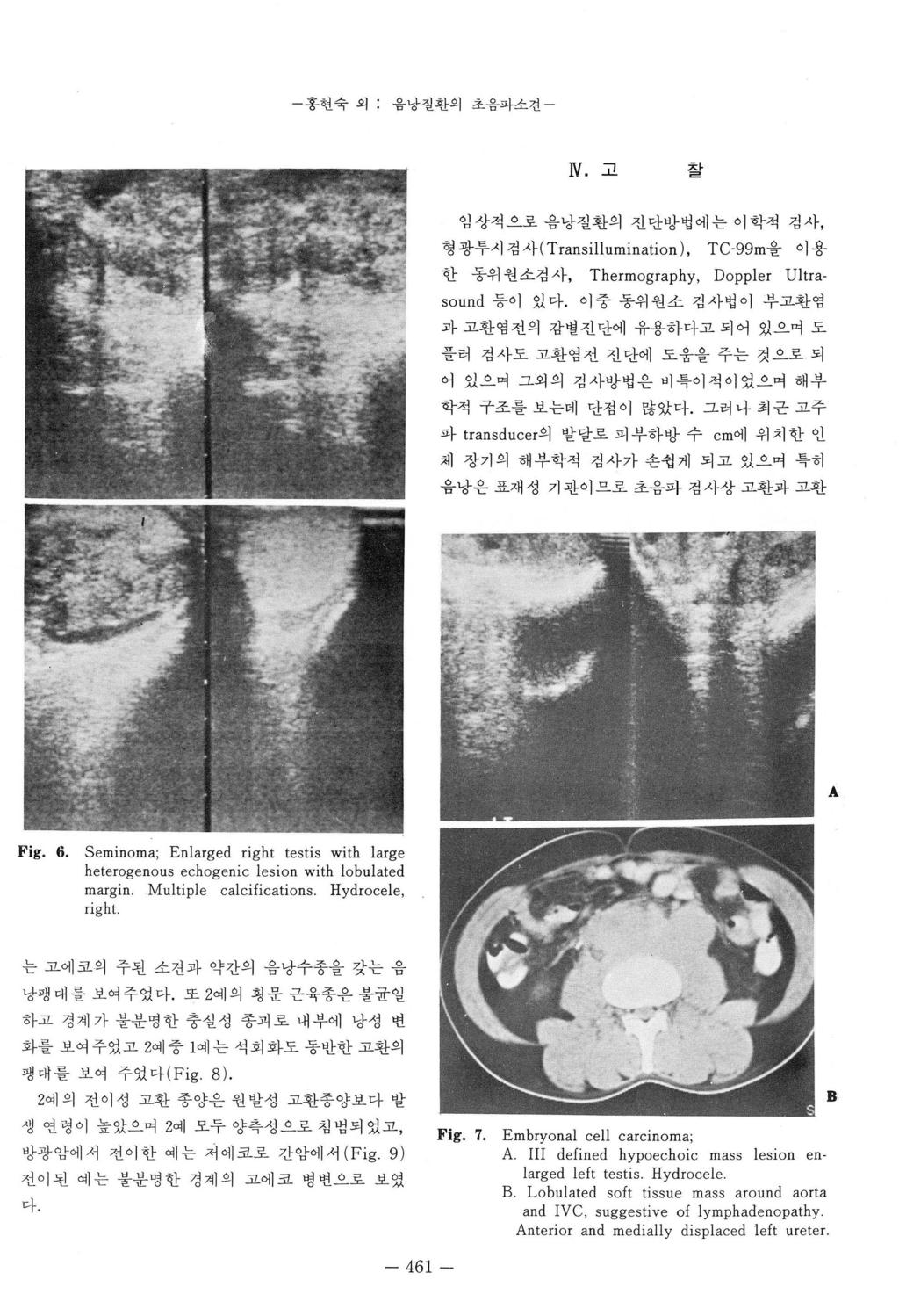 - 홍핸숙외 : 음낭질환의초음파소견 - N. 고찰 임상석으로음낭질환의진단방법에는이학적검사, 형광투시검사 (Transillumination), TC-99m을이용한동위원소검사, Thermography, Doppler Ultrasound 등이있다.