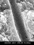 형태는소실되었고잔존하는콜라겐섬유가느슨하게배열되어있으며콜라겐섬유표면에수산화인회석결정이용해되고잔존되어있는양상으로부착되어있었다.