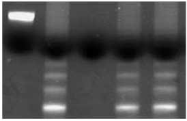 자궁내발달지연태반의 Telomerase 활성도와세포증식 37 완충액에서는 ladder가관찰되지않았다. 본연구에서대조군인정상말기임신태반에서는 20예중 2예 (10%) 에서 telomerase ladder가발현되었고, 자궁내발달지연태반 13예는모두발현되지않았다 (Fig. 1)(Table 2).