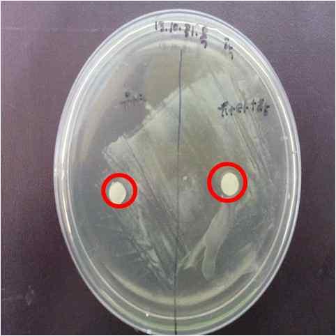 inhibition zone이나타났다.