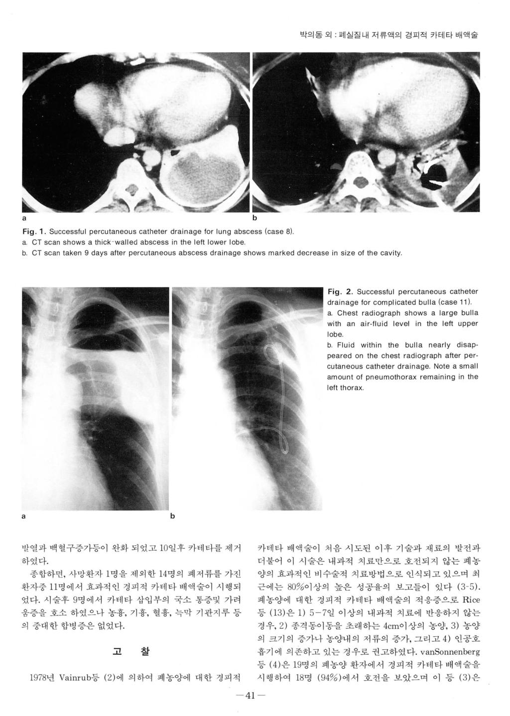 박의동외 - 폐실질내저류액의겸피적카테타배액술 a b Fig.. Successful percutaneous catheter drainage for (case ) a. CT scan shows a thick -walled abscess in the b.