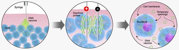 Electroporation