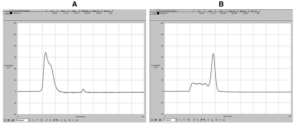 Vol. 15, No. 1 (2009) 진동및충격조건에대한완충재별완충성능분석 5 Fig. 8. Acceleration graph for CorruPad with 49 N (A) and 196 N (B) weight. 따라서, 상기충격및진동실험결과를통해완충재의재질별충격및진동에따른완충성능에대하여다음과같이요약할수있다. 2.