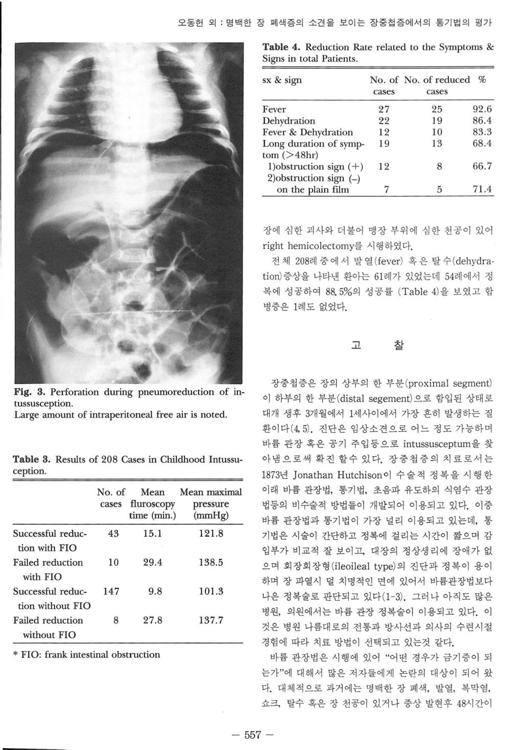 오동헌외 : 명백한장폐색증의소견을보이는장중칩증에서의통기법의평가 Table 4. Reduction Rate related to the Symptoms & Signs in total Patients. sx & sign No. of No. of reduced % cases cases Fever 27 25 92.6 Dehydration 22 19 86.