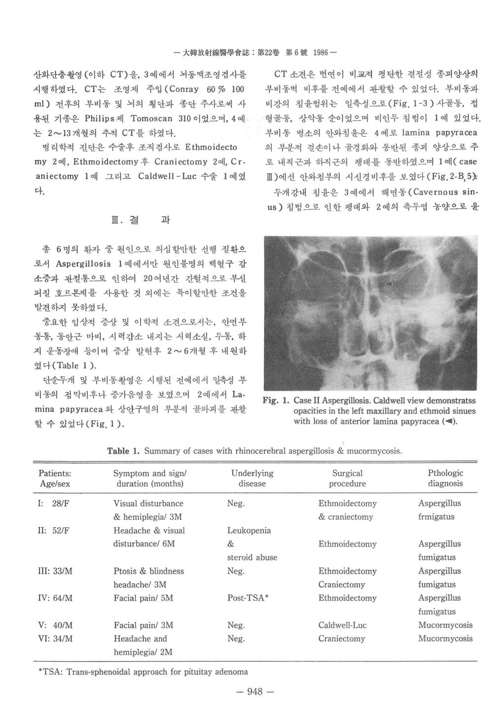 大훌훌放射線醫學會誌 : 第 22 卷第 6 號 1986 - 산화단층촬영 ( 이하 CT) 을, 3 예에서뇌동액조영검사를시행하였다 CT는조영제주엽 (Conray 60 % 100 ml) 전후의부비동빛뇌의횡단과종단주사로써사용펀기종은 Philips 제 Tomoscan 310 이었으며, 4 예는 2~13 개월의추적 CT를하였다.