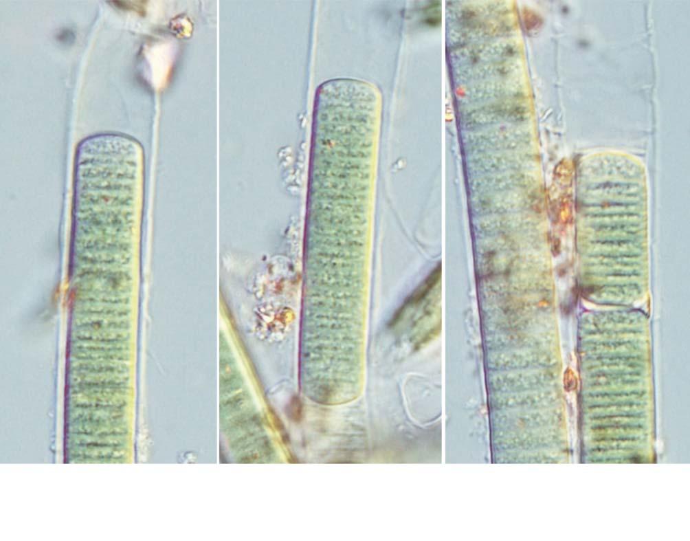 98 (Algae) II :. : (Chung et al. 1968); (Chung 1976); (Wui and Kim 1987); (Lee et al. 1990); (Lee et al. 2008). : (35 49 44 N, 128 44 32 E), 27.ii.2012. :. :. 46.