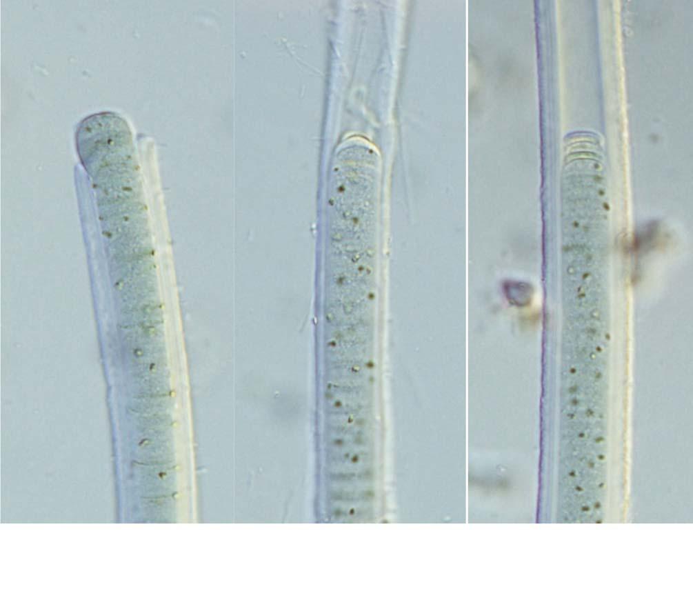 100 (Algae) II A B C 25 μm 51. A C. Lyngbya major. :.