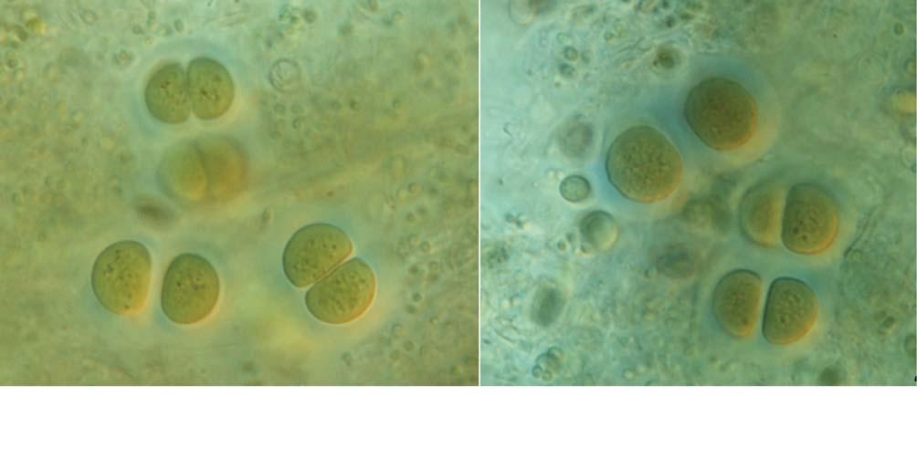 : : 21 8. Chroococcus subnudus (Hansgirg) Cronberg et Komárek 1994 ( 8A, B) Lukavský 1994: 66. pl. I. f. 18. Komárek and Anagnostidis 1999: 306. f. 404. : Chroococcus turgidus var.