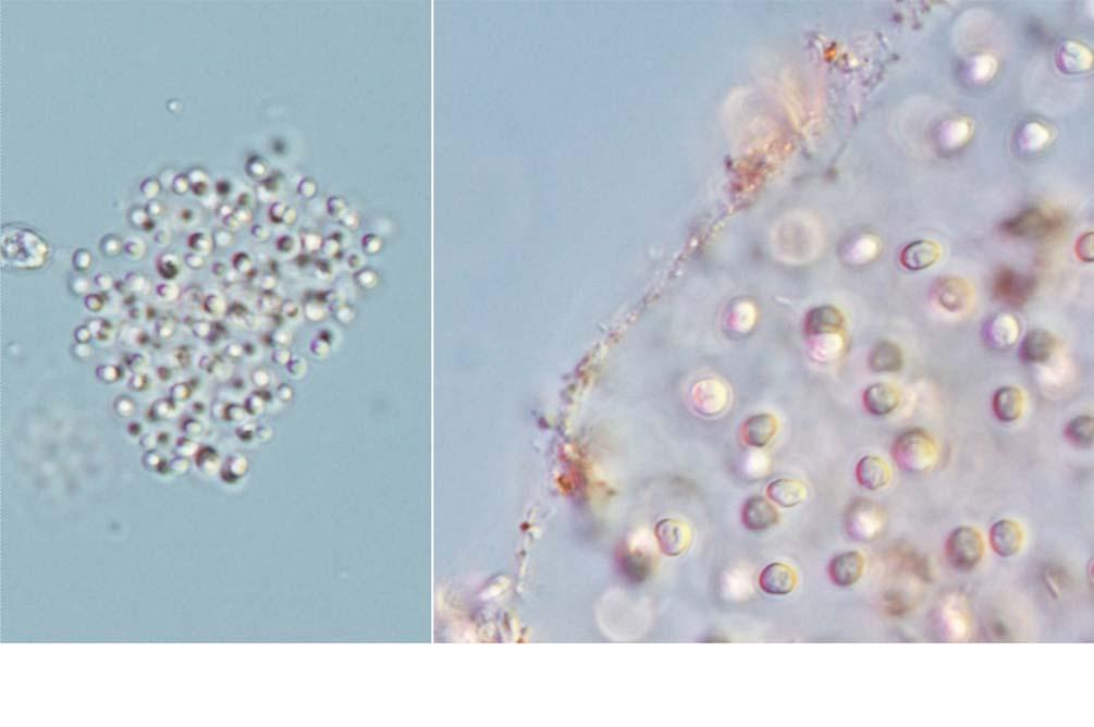 : : 27 A B 25 μm 11. A. Aphanocapsa conferta; B. Aphanocapsa grevillei. : (Lee et al. 2008). : (35 56 29 N, 128 50 08 E), 31.viii.2010. :. : Chung (1993) Yamaghshi Akiyama (1985) Aphanocapsa elachista var.