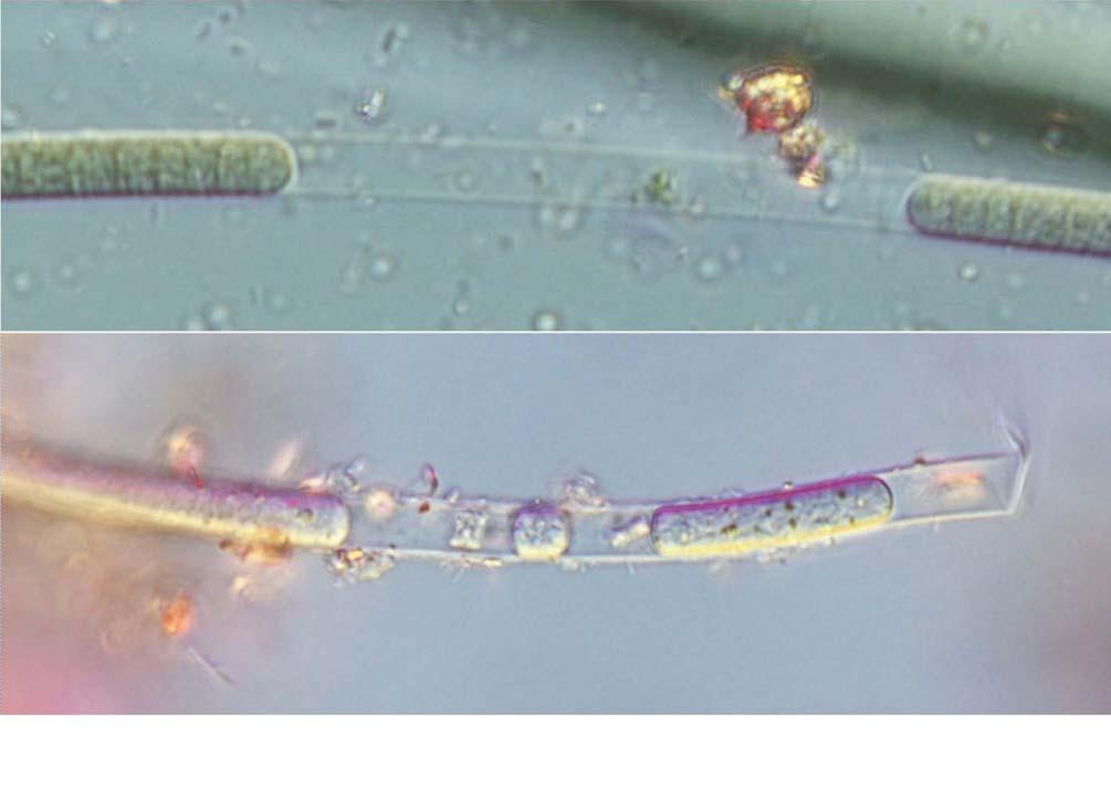 : : 61 A B 25 μm 28. A, B. Phormidium aerugineo-caeruleum. : Oscillatoria aerugino-caerulea Kützing, nom. inval.. :. : (Chung 1976). : (35 09 56 N, 129 07 34 E), 29.ix.