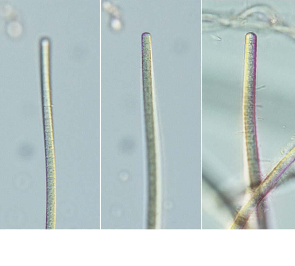 64 (Algae) II A B C 25 μm 30. A, B. Phormidium articulatum; C. Phormidium chlorinum. : (Porto Rico). :. : (Kim et al.