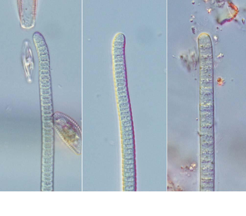 76 (Algae) II 36. Phormidium nigrum (Vaucher ex Gomont) Anagnostidis et Komárek 1988: 405 ( 36A, B). Chung 1993: 221. f. 105. Komárek and Anagnostidis 2005: 449. f. 658. Whitton 2011: 99.