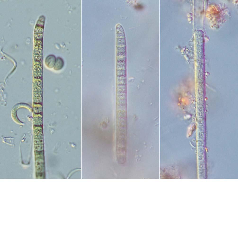 : : 81 A B C 25 μm 39. A C. Phormidium terebriforme...,,,, 4.0 6.5 μm,,.,, 2.0 6.0 ( 7.0) μm long,,.,,..,,.. : (Carlsbad) (Oscillatoria terebriformis C.