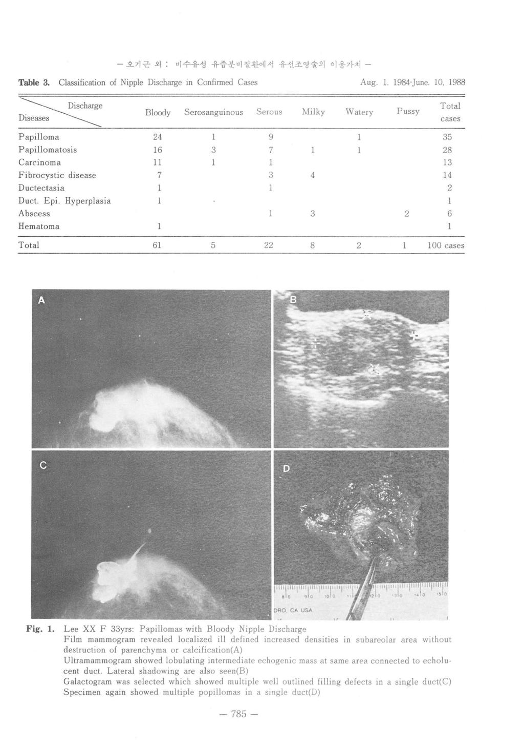 - 오기근외 "1 수유성유즙분비질환에서유션조영술의이용가치 - Table 3. Classification of Nipple Discharge in Confinned Cases Aug. 1. 198-June. 10, 1988 ----------.