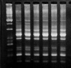 유전자종분석을이용한 Acinetobacter 의균종동정 51 M 1 2 3 4 5 6 7 M 1 2 3 4 5 6 300 bp 200 bp 175 bp 150 bp 100 bp 300 bp 200 bp 175 bp 150 bp Fig. 2. trna-ilp patterns of 7 type strains of Acinetobacter species in a 6% agarose gel electrophoresis.