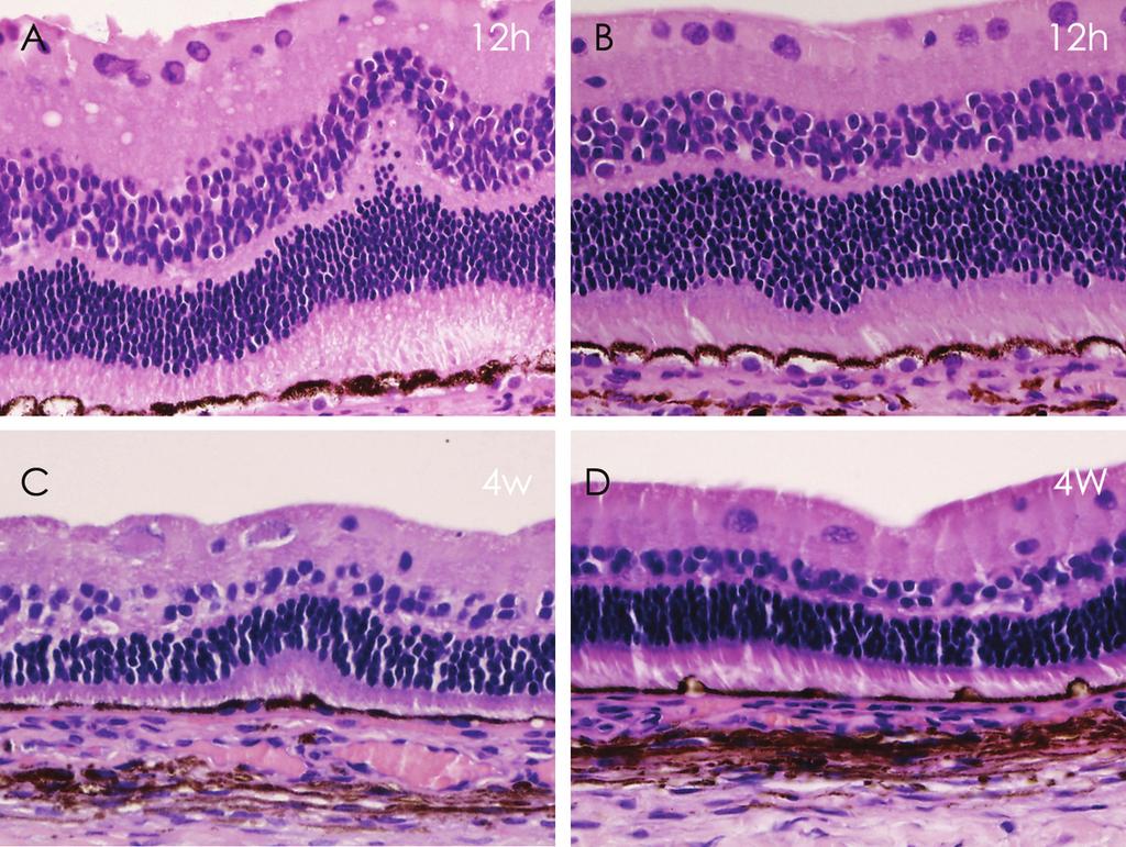 - 이주은 외 : 역치하 레이저 광응고반의 조직 변화 - Figure 2. H&E stained histological findings of the long duration (LD, A and C) and short duration (SD, B and D) subthreshold laser group. 400.