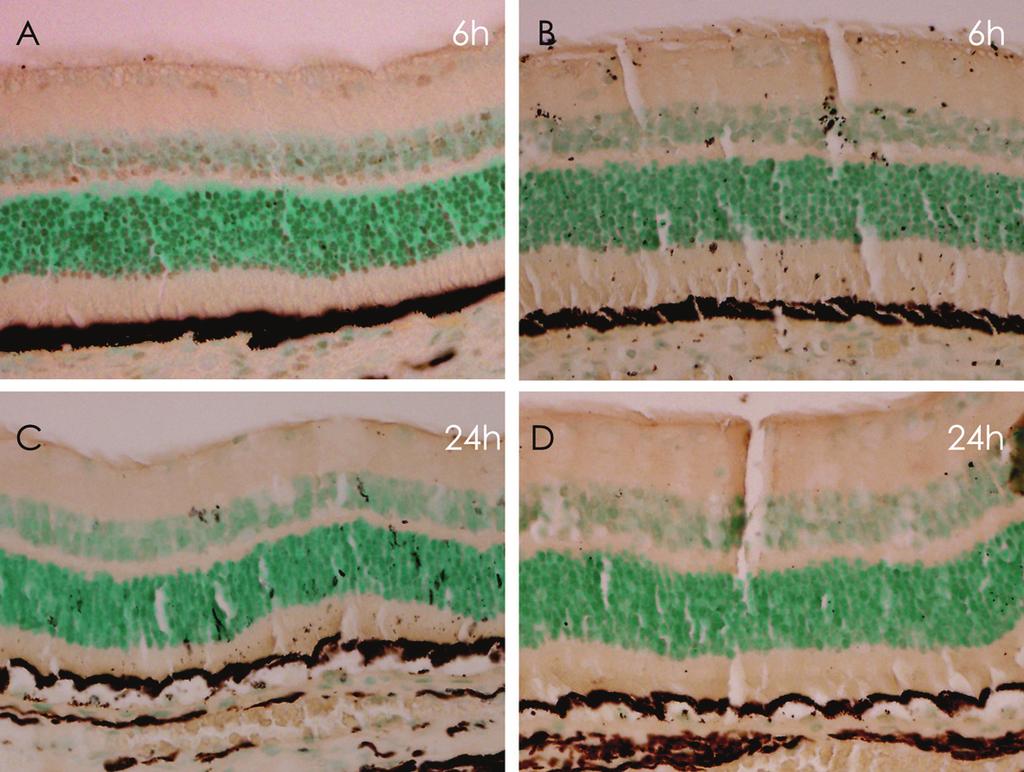 - 대한안과학회지 2009 년제 50 권제 3 호 - Figure 3. TUNEL staining of the long duration (LD, A and C) and short duration (SD, B and D) subthreshold laser group, 400.