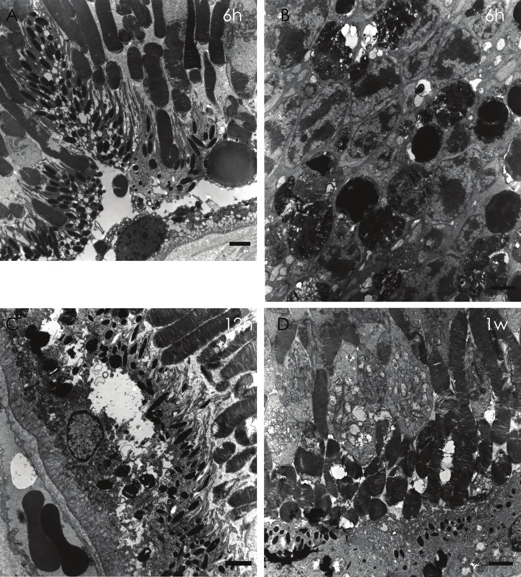 - 이주은 외 : 역치하 레이저 광응고반의 조직 변화 - Figure 4. Transmission electron micrograph of LD group. (A) Six hours after the laser.