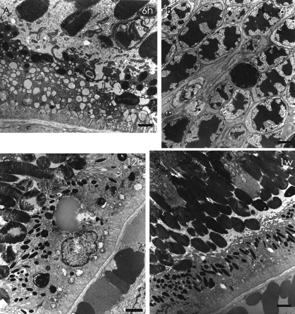 - 대한안과학회지 2009년 제 50 권 제 3 호 - Figure 5. Transmission electron micrograph of SD group. (A) Six hours after the laser.